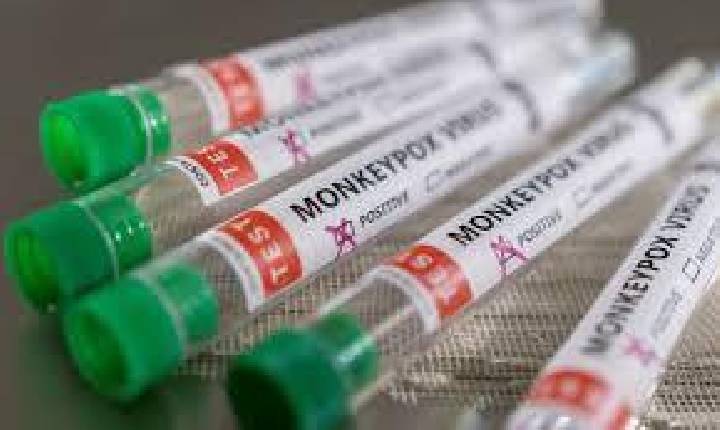 Governo de SC confirma transmissão local da varíola dos macacos