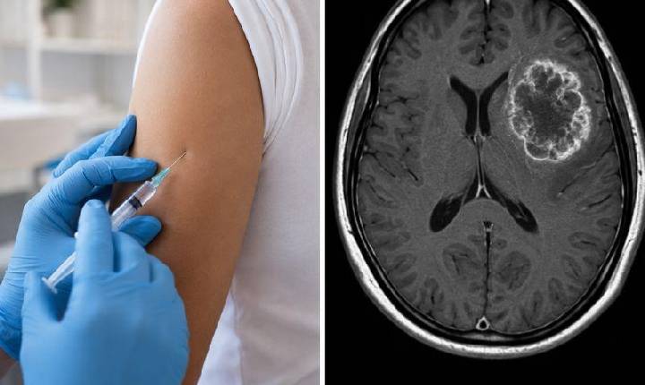 Vacina experimental contra tumor cerebral impede volta do câncer em 42% dos pacientes; estudo