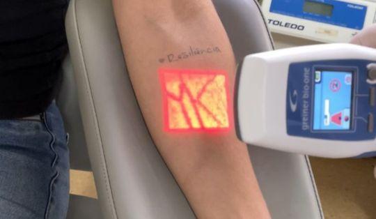 Equipamento utilizado para visualizar veias facilita coleta de sangue no Hemosc